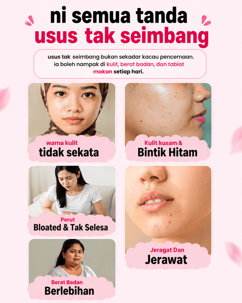 Infografik tanda usus tidak seimbang dan keadaan kulit kusam